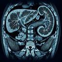 МРТ підшлункової залози