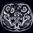 МРТ малого тазу у чоловіків